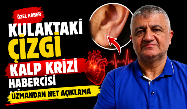 Kulak Memesindeki Çizgi Kolesterolün Habercisi Olabilir